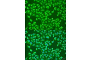 Immunohistochemistry of paraffin-embedded human liver using  Rabbit pAb (ABIN6131168, ABIN6136442, ABIN6136443 and ABIN6224114) at dilution of 1:25 (40x lens). (ACOX1 antibody  (AA 1-270))