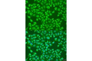 Immunohistochemistry of paraffin-embedded human liver using  Rabbit pAb (ABIN6131168, ABIN6136442, ABIN6136443 and ABIN6224114) at dilution of 1:25 (40x lens).