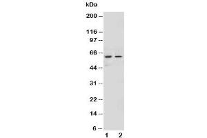Western blot testing of NOX1 antibody and Lane 1:  HeLa (NOX1 antibody  (AA 354-374))
