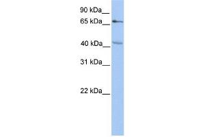 CHST13 antibody used at 1 ug/ml to detect target protein.