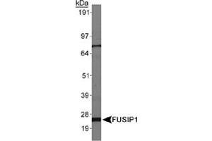 Western blot analysis of FUSIP1, isoform 3, in HepG2 whole cell lysates using FUSIP1 polyclonal antibody .