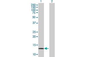 Western Blot analysis of LDOC1 expression in transfected 293T cell line by LDOC1 MaxPab polyclonal antibody. (LDOC1 antibody  (AA 1-146))