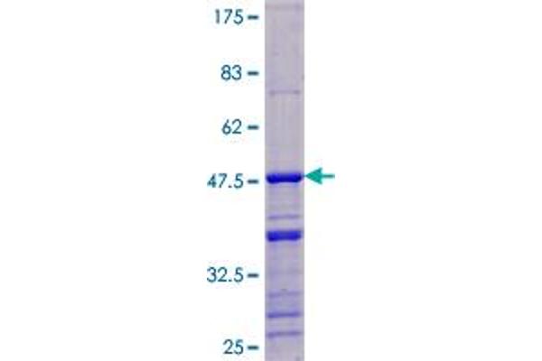 DDX17 Protein (AA 1-183) (GST tag)