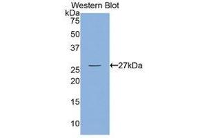 Western Blotting (WB) image for anti-Myosin Light Chain Kinase (MYLK) (AA 1661-1877) antibody (ABIN1859947) (MYLK antibody  (AA 1661-1877))