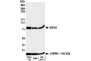 Western Blotting (WB) image for anti-Enhancer of Zeste Homolog 2 (EZH2) (C-Term) antibody (ABIN7795723)
