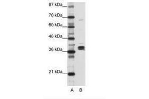 Image no. 1 for anti-Heterogeneous Nuclear Ribonucleoprotein D-Like (HNRPDL) (AA 119-168) antibody (ABIN203083) (HNRPDL antibody  (AA 119-168))