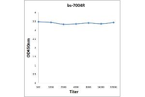 Antigen: 0. (PRAME antibody  (AA 151-250))
