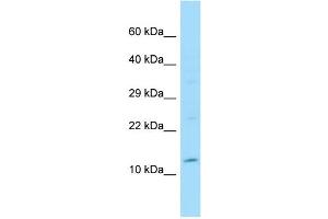 WB Suggested Anti-SYCN Antibody Titration: 1. (SYCN antibody  (N-Term))