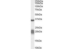 Western Blotting (WB) image for anti-Arginase, Liver (ARG1) (AA 316-330) antibody (ABIN295463) (Liver Arginase antibody  (AA 316-330))
