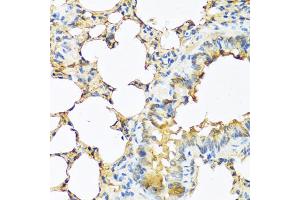 Immunohistochemistry of paraffin-embedded mouse lung using TSHB antibody (ABIN5974108) at dilution of 1/100 (40x lens). (TSHB antibody)