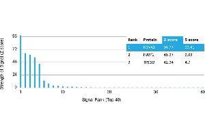 Protein Array (PAr) image for anti-Neuro-Oncological Ventral Antigen 1 (NOVA1) antibody (ABIN7456055) (NOVA1 antibody)