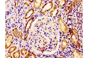 IHC image of ABIN7151882 diluted at 1:400 and staining in paraffin-embedded human kidney tissue performed on a Leica BondTM system. (EPS8 antibody  (AA 572-670))