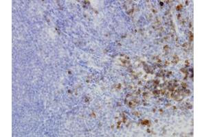 Image no. 1 for anti-Homocysteine-Inducible, Endoplasmic Reticulum Stress-Inducible, Ubiquitin-Like Domain Member 1 (HERPUD1) (AA 74-181) antibody (ABIN466153) (HERPUD1 antibody  (AA 74-181))