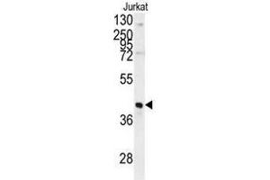 Image no. 1 for anti-Fructose-1,6-Bisphosphatase 1 (FBP1) (N-Term) antibody (ABIN452993) (FBP1 antibody  (N-Term))