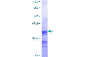 PCYT1B Protein (AA 236-314) (GST tag)