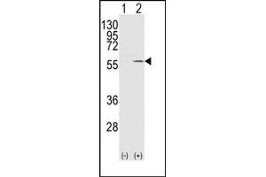 Image no. 1 for anti-Vimentin (VIM) antibody (ABIN357886) (Vimentin antibody)