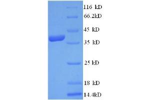 SDS-PAGE (SDS) image for 3-Hydroxy-3-Methylglutaryl-CoA Reductase (HMGCR) (AA 588-887), (partial) protein (His tag) (ABIN5709669) (HMGCR Protein (AA 588-887, partial) (His tag))