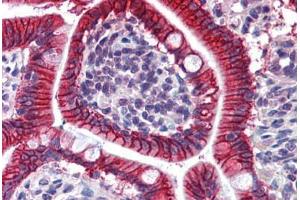 Human Small Intestine: Formalin-Fixed, Paraffin-Embedded (FFPE) (LI Cadherin antibody  (AA 24-132))