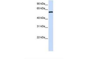 Image no. 1 for anti-Metaxin 1 (MTX1) (AA 326-375) antibody (ABIN6738154) (Metaxin 1 antibody  (AA 326-375))