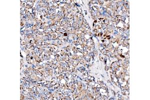 IHC analysis of Paxillin/PXN using anti-Paxillin/PXN antibody (ABIN7602636). (Paxillin antibody  (AA 9-570))