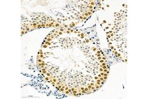 Immunohistochemistry (Paraffin-embedded Sections) (IHC (p)) image for anti-Stem-Loop Binding Protein (SLBP) antibody (ABIN7075733)