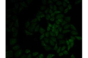 Immunofluorescence analysis of HeLa cells using MSN antibody. (Moesin antibody  (AA 1-300))