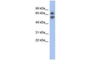 Image no. 1 for anti-Programmed Cell Death 7 (PDCD7) (C-Term) antibody (ABIN6744321) (PDCD7 antibody  (C-Term))