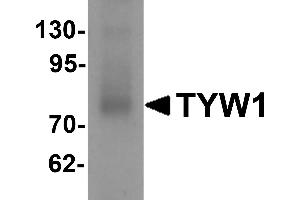 Western blot analysis of TYW1 in human lung tissue lysate with TYW1 antibody at 1 µg/mL. (TYW1 antibody  (C-Term))