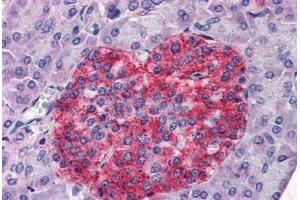 Human Pancreas (formalin-fixed, paraffin-embedded) stained with ANXA10 antibody ABIN351461 at 3. (Annexin a10 antibody  (AA 2-16))