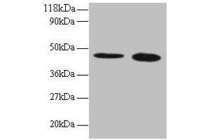 Western blot All lanes: TTC1 antibody at 2 μg/mL Lane 1: 293T whole cell lysate Lane 2: EC109 whole cell lysate Secondary Goat polyclonal to rabbit IgG at 1/15000 dilution Predicted band size: 34 kDa Observed band size: 45 kDa (TTC1 antibody  (AA 3-292))