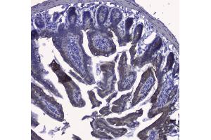 IHC analysis of Cytokeratin 19 using anti-Cytokeratin 19 antibody (ABIN3043288). (Cytokeratin 19 antibody  (C-Term))