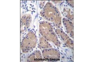 CA1 Antibody immunohistochemistry analysis in formalin fixed and paraffin embedded human stomach tissue followed by peroxidase conjugation of the secondary antibody and DAB staining. (CA1 antibody  (N-Term))