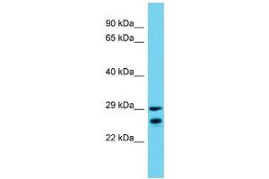 Host: Rabbit  Target Name: Zar1l  Sample Tissue: Mouse Testis lysates  Antibody Dilution: 1. (ZAR1L antibody  (C-Term))