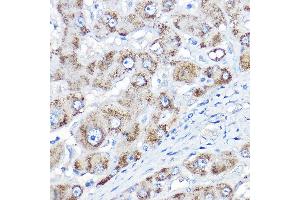 Immunohistochemistry of paraffin-embedded human liver using AGXT Rabbit pAb  at dilution of 1:150 (40x lens). (AGXT antibody  (AA 183-392))