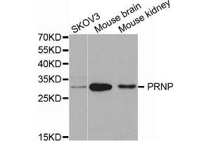 Western blot analysis of extracts of various cell lines, using PRNP antibody. (PRNP antibody  (AA 23-230))