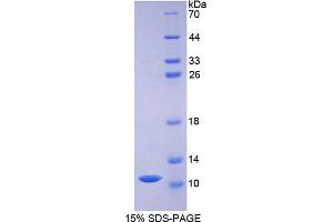 SDS-PAGE analysis of Pig Defensin beta 1 Protein. (beta Defensin 1 Protein)