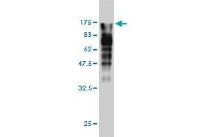 Western Blot detection against Immunogen (123. (MVP antibody  (AA 1-893))