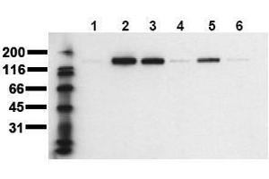 Western Blotting (WB) image for anti-Receptor tyrosine-protein kinase erbB-2 (ErbB2/Her2) (pThr686) antibody (ABIN126787) (ErbB2/Her2 antibody  (pThr686))