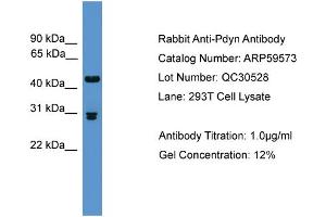WB Suggested Anti-Pdyn  Antibody Titration: 0. (PDYN antibody  (Middle Region))