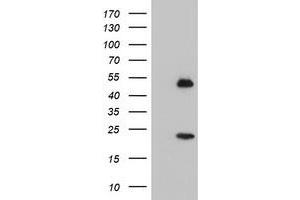 HEK293T cells were transfected with the pCMV6-ENTRY control (Left lane) or pCMV6-ENTRY NUCB1 (Right lane) cDNA for 48 hrs and lysed. (Nucleobindin 1 antibody)