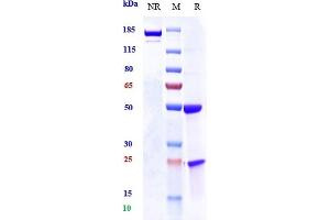 Anti-PRLR / Prolactin Receptor Reference Antibody (BAY 1158061) on SDS-PAGE under reducing (R) condition.