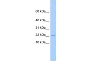 Western Blotting (WB) image for anti-Golgin A7 Family, Member B (GOLGA7B) antibody (ABIN2463629) (GOLGA7B antibody)