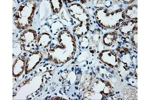Immunohistochemical staining of paraffin-embedded Kidney tissue using anti-PLEK mouse monoclonal antibody. (Pleckstrin antibody)