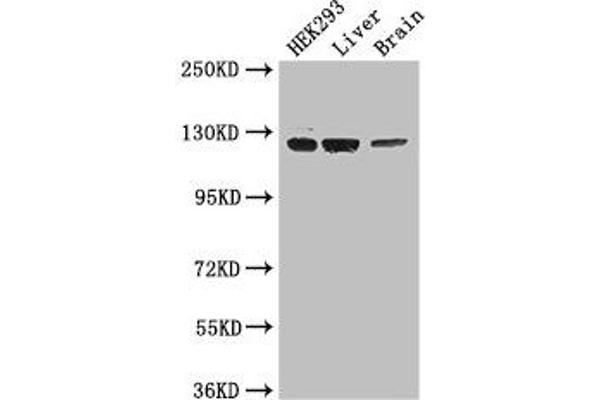GUCY2C Antikörper  (AA 636-891)