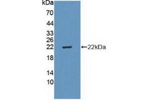 Detection of Recombinant CDKN2D, Human using Polyclonal Antibody to Cyclin Dependent Kinase Inhibitor 2D (CDKN2D) (CDKN2D antibody  (AA 1-166))