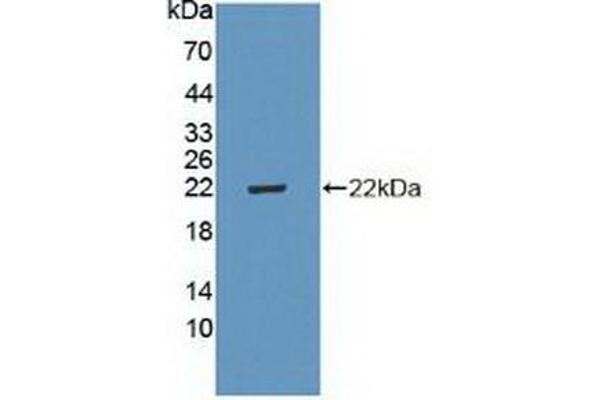 CDKN2D Antikörper  (AA 1-166)