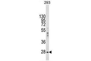 EIF2B1 Antibody (Center) western blot analysis in 293 cell line lysates (35µg/lane). (EIF2B1 antibody  (Middle Region))