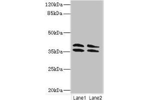 Western blot All lanes: CA10 antibody at 4 μg/mL Lane 1: HL60 whole cell lysate Lane 2: Mouse brain tissue Secondary Goat polyclonal to rabbit IgG at 1/10000 dilution Predicted band size: 38, 30 kDa Observed band size: 38 kDa (CA1 antibody  (AA 61-320))