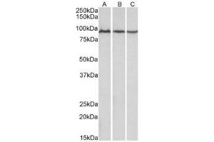 AP21267PU-N ACO2 Antibody staining of Mouse (A), Rat (B) and Pig (C) Skeletal Muscle lysates at 0. (ACO2 antibody  (Internal Region))