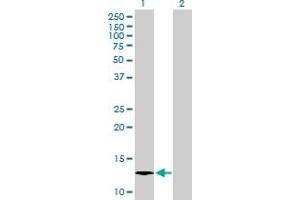 Western Blot analysis of C1orf38 expression in transfected 293T cell line by C1orf38 MaxPab polyclonal antibody. (C1orf38 antibody  (AA 1-132))
